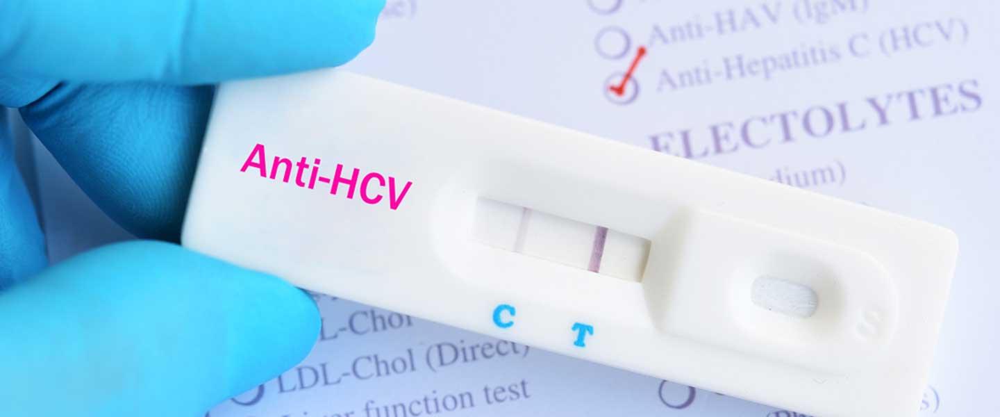 Anti HCV Nedir?